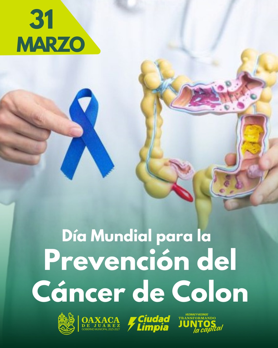 Día Mundial para la Prevención del Cáncer de Colon